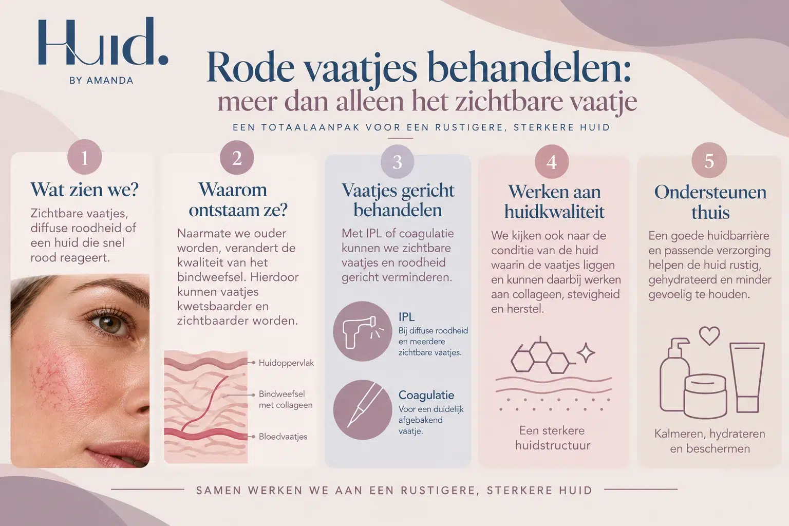 Infographic rode vaatjes behandelen: meer dan alleen het zichtbare vaatje