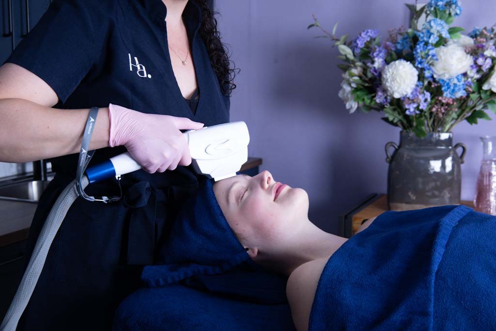 IPL-behandeling bij Huid. by Amanda